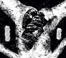 Atrax Morgue: 195 MELROSE AV NW2 + BONUS TRACKS CD